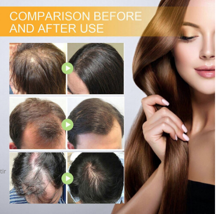 Spray Capilar con Biotina – Estimula el Crecimiento y Fortalece el Cabello (30 ml)
